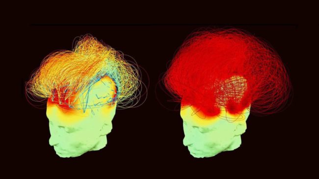 la méditation et ses effets sur le cerveau